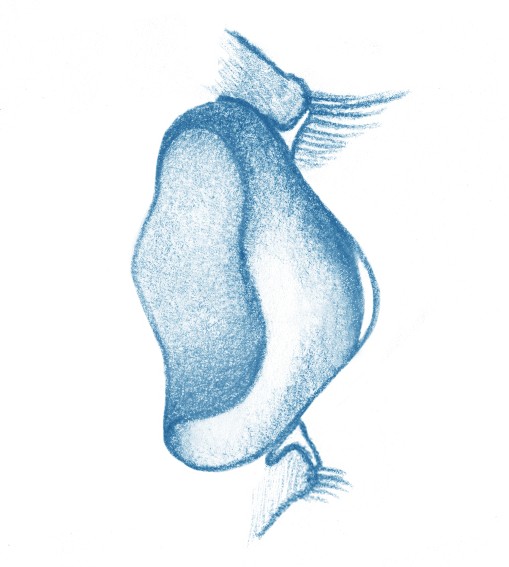 Protesi per ptosi palpebrali - Oftalmica Iris - Protesi Oculari Genova